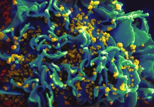 Stop Aids by shunning risky sexual behavior