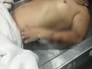 Consolacion dad hacked to death